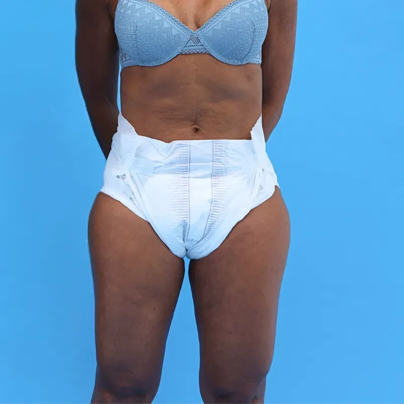 fralda-noturna-vestindo-frente-zoom